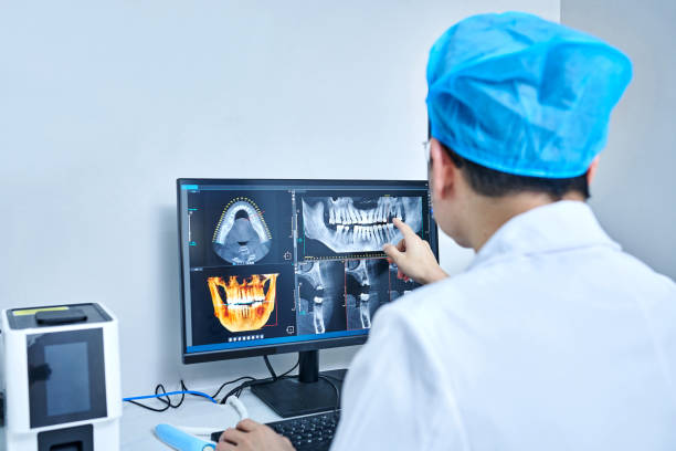 Best Knocked-Out Tooth (Avulsed Tooth) Treatment in Mansura, LA