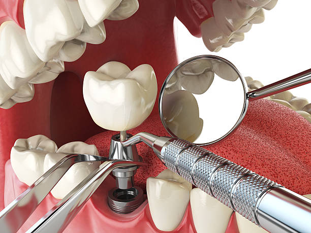 Best Walk-In Emergency Dental Services in Mansura, LA